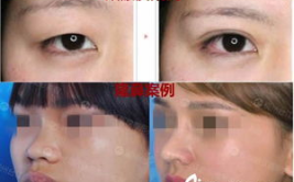 整形外科 排名,2025年度中国整形外科医院综合实力排行榜揭晓